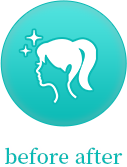 ビフォーアフター