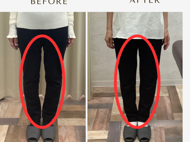 股関節の痛みは。。。