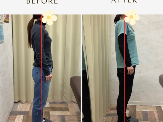 反り腰になっていませんか？