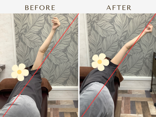 四十肩・五十肩になっていませんか？