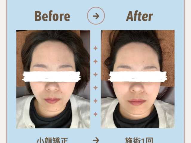 肩こりからくる吐き気に注意！