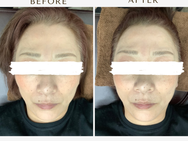 眼精疲労を感じる方は？