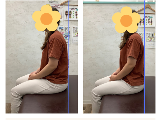 なぜ肩こりは、おこる？