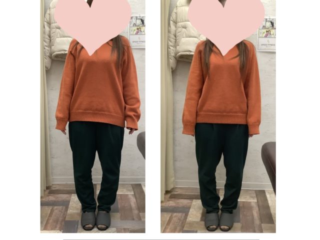 むくみ改善の仕方