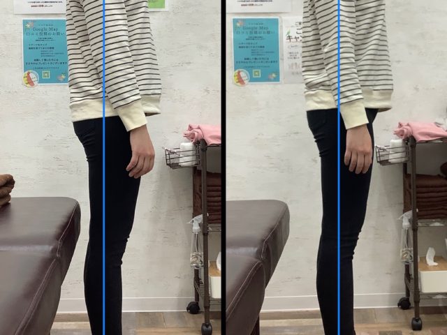 前ももが張るのはなぜ？