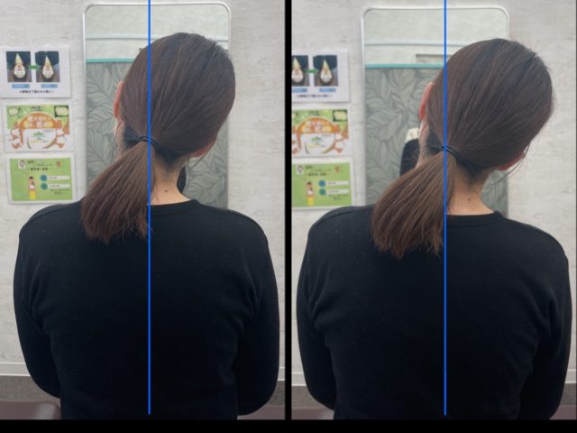 大人気の新メニュー首肩こり整体！