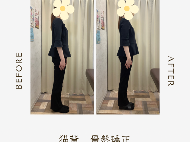 反り腰になっていませんか